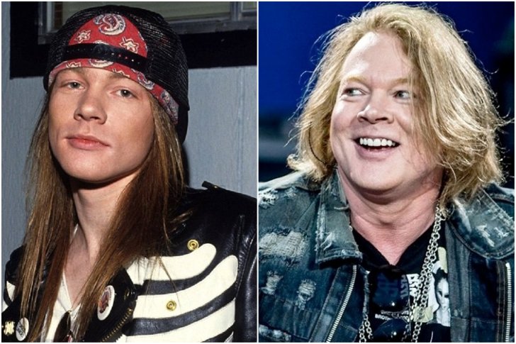 Axl Rose, 58 - Extra Pounds.